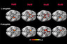 Томограмма мозга гетеро- и гомосексуальных мужчин и женщин