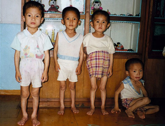 Дети - жертвы голода в КНДР. Июнь 1997 года