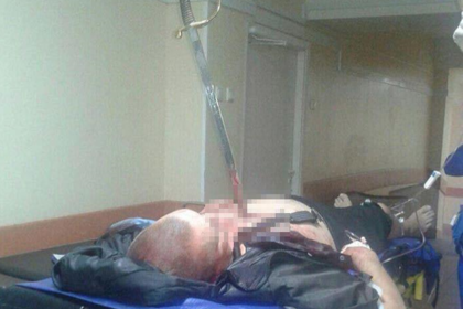 В одну из больниц Москвы доставлен мужчина с саблей XIX века в груди