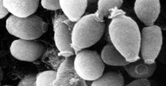 Wangiella dermatitidis под электронным микроскопом.Изображение iqb.es
