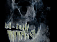 Рентгеновский снимок челюстей мумии Хатшепсут. Фото AFP