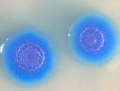 Колонии Mycoplasma mycoides, полученные при помощи вставки искусственного генома в клетки M. capricolum. Фото авторов исследования