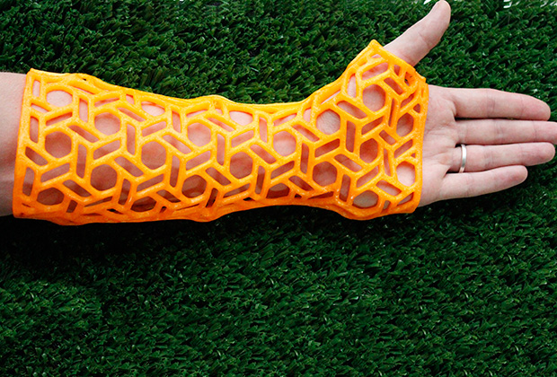 Жесткий ортез для руки, напечатанный на 3D-принтере