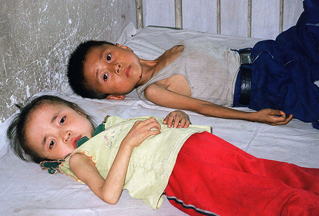 Дети — жертвы голода в КНДР, июнь 1997 года