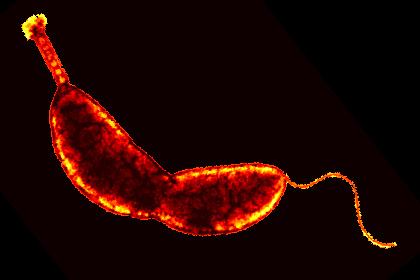 Caulobacter crescentus