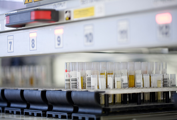 В стандартной лаборатории Abbott анализ крови проводится по 160 показателям