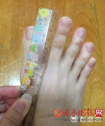 Снимок аномально длинных пальцев ног заставил пользователей сети поломать голову