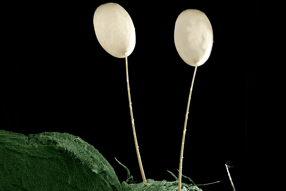 Яйца флерницы под микроскопом (увеличение в 85 раз)
