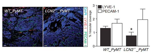 Влияние LCN2, синтезируемого раковыми клетками и макрофагами, на образование кровеносных и лимфатических сосудов