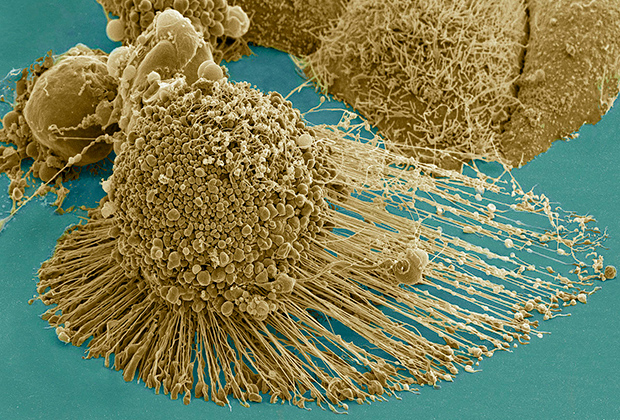 Раковые клетки HeLa