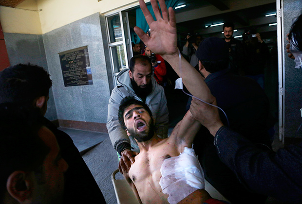 Кашмирец, раненный во время протестов на выборах
