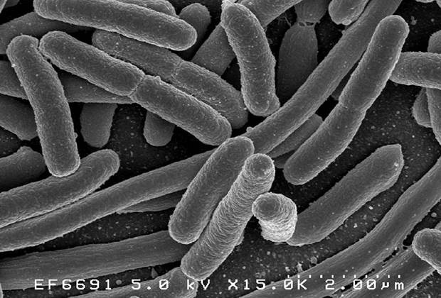 Кишечная палочка Escherichia coli