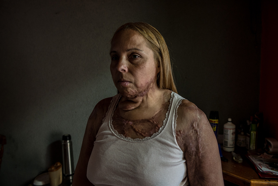 Каждые 18 часов в Аргентине убивают одну женщину. Начиная с 2015 года по стране прокатилась волна жестоких расправ над женщинами: одних сжигали  заживо, других рубили на куски мачете. Чудовищные преступления всколыхнули страну и активизировали феминистское движение. Против гендерного насилия выступил и фотограф Карл Манчини. В фотосерии «Не меньше» он рассказал об ужасах, с которыми сталкиваются латиноамериканки.