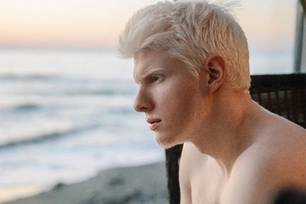 Сын грузина. Бера Иванишвили альбинос. Сын Иванишвили альбинос. Грузинский певец альбинос. Бидзины Иванишвили бера.