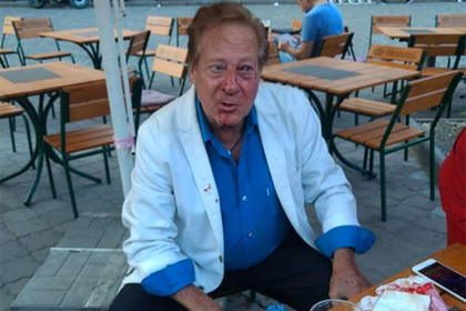 Неизвестный избил американского певца Билла Уоррена в центре Одессы