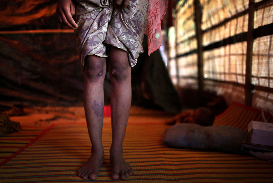 Для некоторых рохинджа, забеременевших после изнасилований, рождение ребенка от немусульманина — хуже смерти. Поэтому женщины часто обращаются в клиники или подпольные аптеки за средствами для аборта.