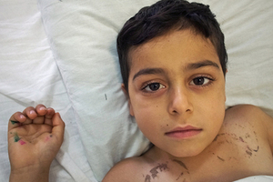 «Мне сейчас нельзя умирать» Семилетнего ребенка спасет трансплантация костного мозга