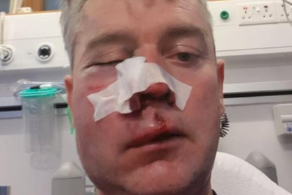 В Ирландии футболисты напали на судью и переломали ему кости