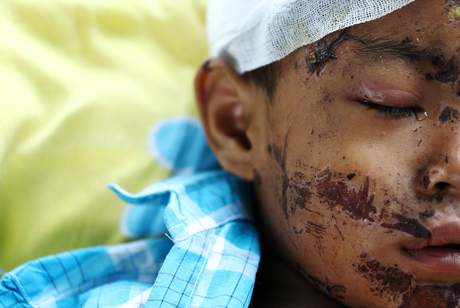 Мальчик, пострадавший от землетрясения и цунами в Индонезии. В результате разгула стихии на острове Сулавеси погибли больше 1,4 тысячи человек. 
