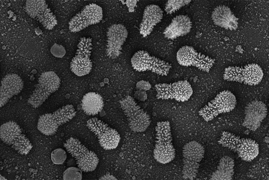 Крупнейшие в мире вирусы рода Tupanvirus, найденные в амебах, имеют длинные хвосты и обладают самым большим набором кодирующих белок генов среди всех известных вирусов.