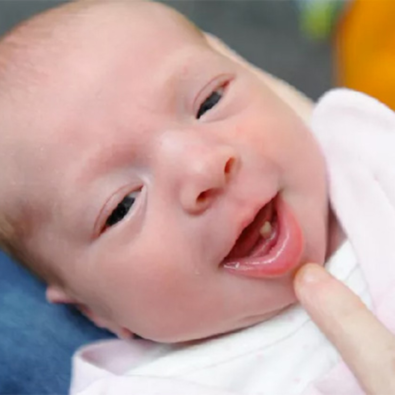 Новорождённые дети с зубами
