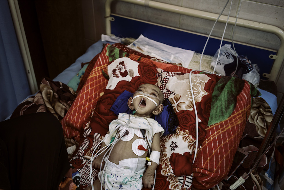 Фрагмент репортажа фотографа The Washington Post Лоренцо Тугноли из Йемена, «Йеменский кризис». За последний год в стране активизировалась теневая война между местными йеменскими боевиками и «Аль-Каидой», из-за чего страдает мирное население. Номинант в категории «Истории». 


