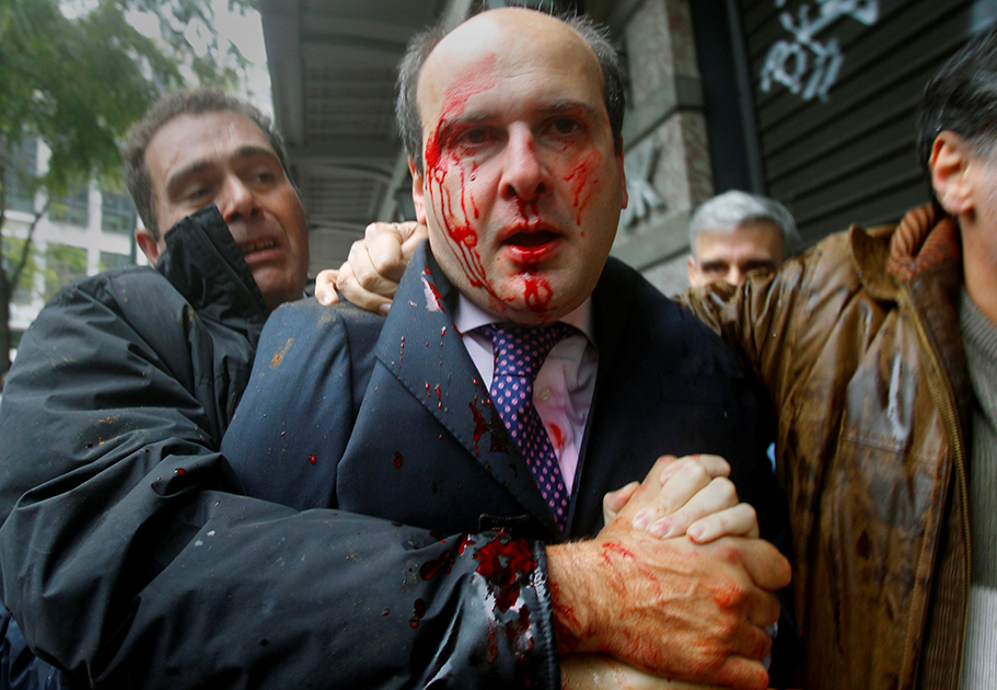 Бывший министр развития Греции Костис Хадзидакис после нападения у здания парламента во время всеобщей забастовки 15 декабря 2010 года. Десятки протестующих, недовольных работой правительства, напали на него в центре Афин и избили. 