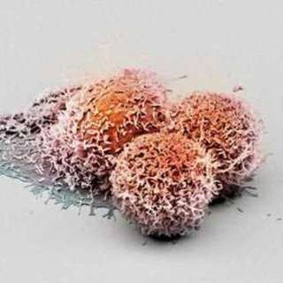 Изображение раковых клеток