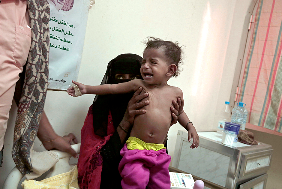Мирное население Йемена страдает от голода, а гуманитарная помощь доходит далеко не до всех. На фото — оголодавшая мать пытается спасти своего заболевшего годовалого сына. Малыша рвало, он кашлял и страдал поносом. Семья Молхам может позволить кормить малыша смесью только раз в день.