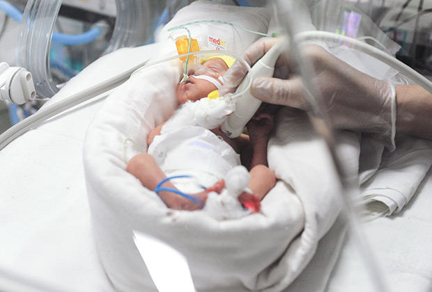 Новорожденный ребенок в кувезе в отделении реанимации и интенсивной терапии новорожденных