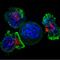 Т-клетки-убийцы окружают раковые клетки