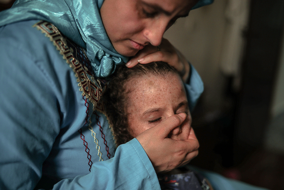 Мария Эль-Маруфи (Maria El Maroufi) и ее шестилетняя дочь, страдающая ксеродермой