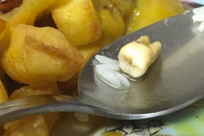 Ресторан придумал нелепое оправдание найденному в блюде человеческому зубу