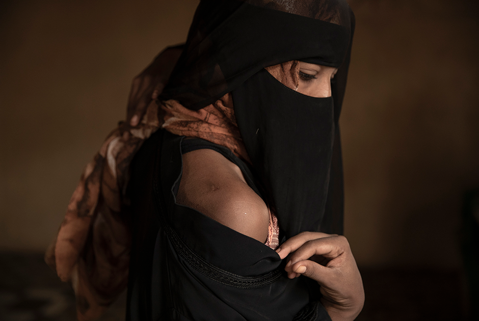 27-летняя Эман Идрис и ее муж заплатили контрабандистам 700 долларов, чтобы добраться до Саудовской Аравии. Однако в Йемене их продержали в заточении восемь месяцев. Женщина рассказывает о жестоких побоях и показывает шрамы. По ее словам, паре не давали уйти, потому что контрабандист «хотел ее».

