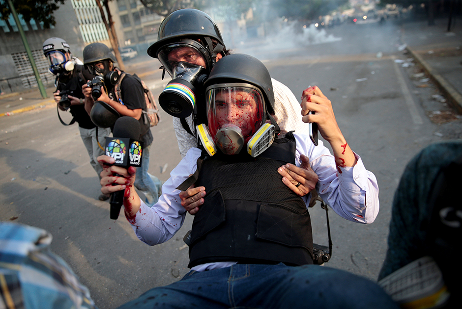 Пострадавшего сотрудника СМИ уносят во время акции протеста против правительства президента Венесуэлы Николаса Мадуро, приуроченной к празднику Первомая в Каракасе. Акция началась с неудачной попытки переворота со стороны лидера оппозиции. «День прошел, наполненный слезоточивым газом, резиновыми пулями, камнями, бутылками с зажигательной смесью и боевыми патронами», — вспоминают очевидцы. Во второй половине дня чиновники задержали протестующего с самодельным минометом. Полиция велела сотрудникам СМИ отойти, однако местный тележурналист Грегори Хаймес проигнорировал предупреждение. Национальная гвардия активировала устройство и бросила в Хаймеса. Он не понял, что произошло, пока не выплюнул кровь в противогаз, — челюсть была поражена шрапнелью. Коллеги бросились на помощь. 
