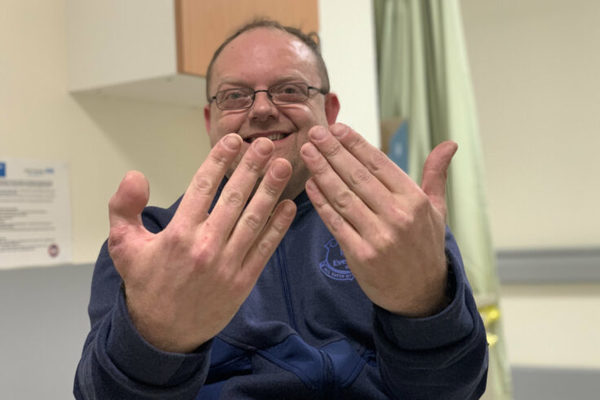 Вывих фаланги пальца | Клиника “Гармония Мед”