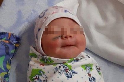 В российском роддоме новорожденной порезали лицо