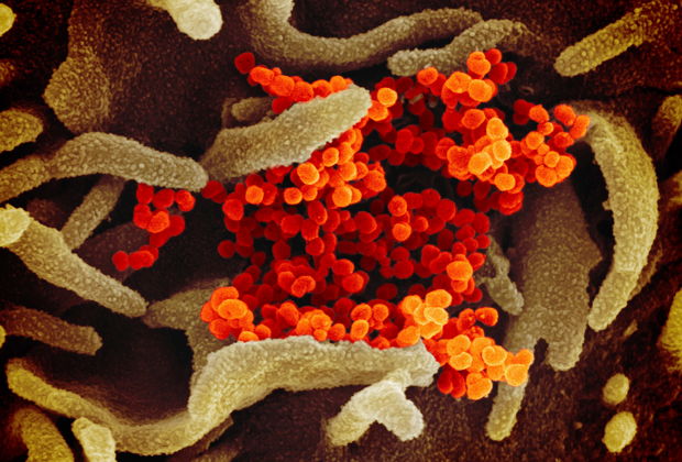 Вирус SARS-CoV-2 (оранжевый), вызывающий COVID-19, на поверхности клетки под микроскопом