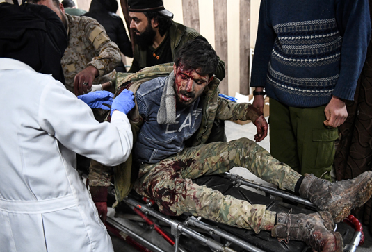 Раненый в ходе сражения с правительственной армией протурецкий боевик 