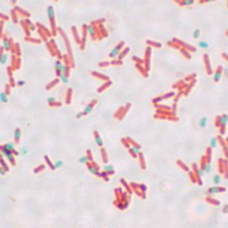 Споры Bacillus subtilis (зеленые)