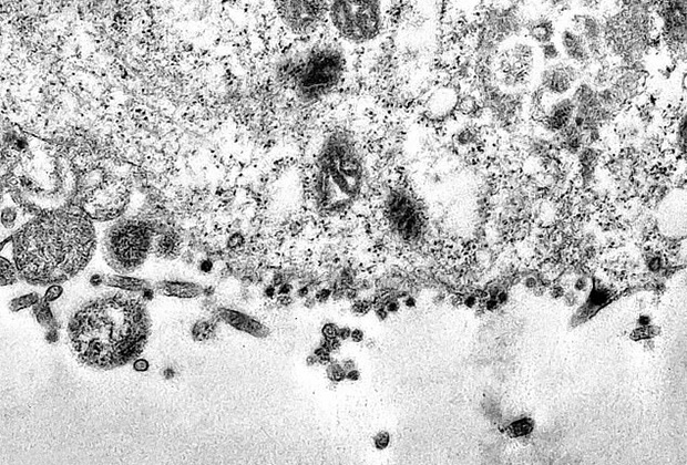 Первые снимки нового коронавируса под микроскопом