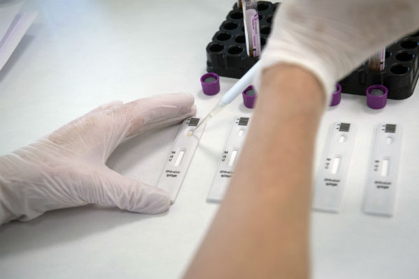 Экспресс-тестирование на коронавирус в лаборатории в клинике «Хадасса»