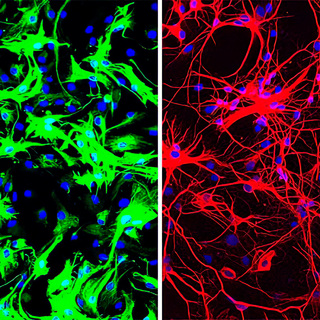 Астроциты (слева) до перепрограммирования в нейроны (справа)