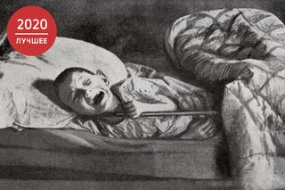Умирающий от голода ребенок в больнице Самары. 1921-1923 гг.