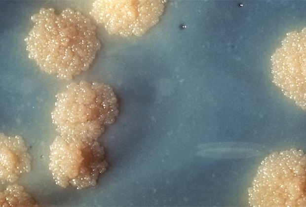 Туберкулезная палочка под микроскопом