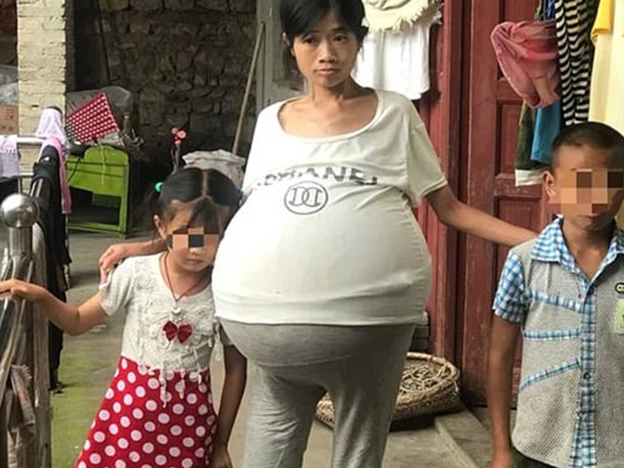 2 ребенок с огромным. Хуан Госянь большой живот. Китаянка у которой вырос огромный живот.