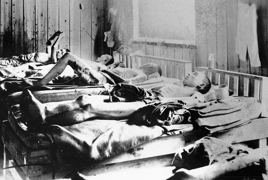 Жители Хиросимы, уцелевшие во время ядерной бомбардировки и умирающие от радиации