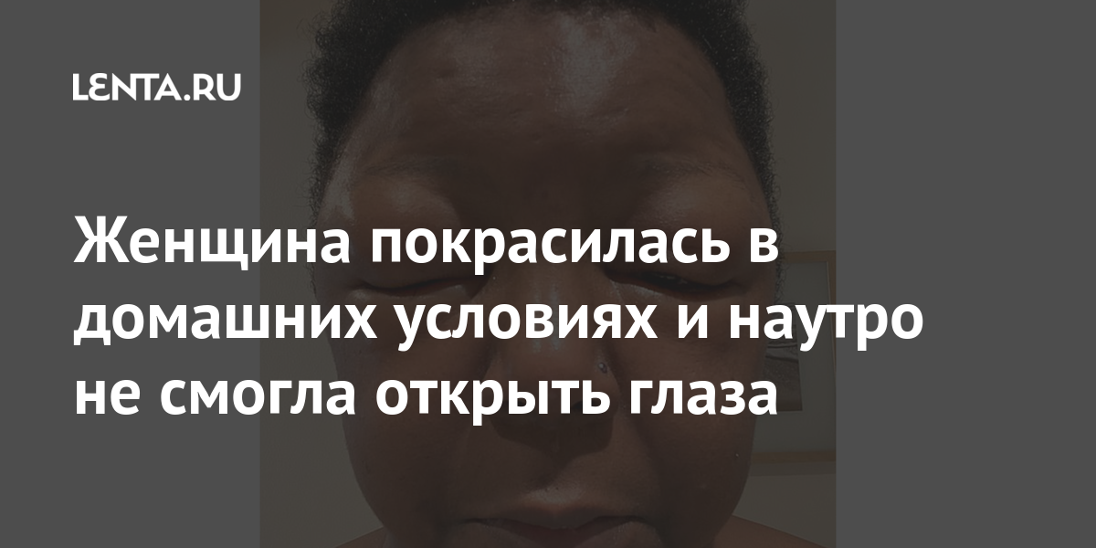 Женщина покрасилась в домашних условиях и наутро не смогла открыть глаза