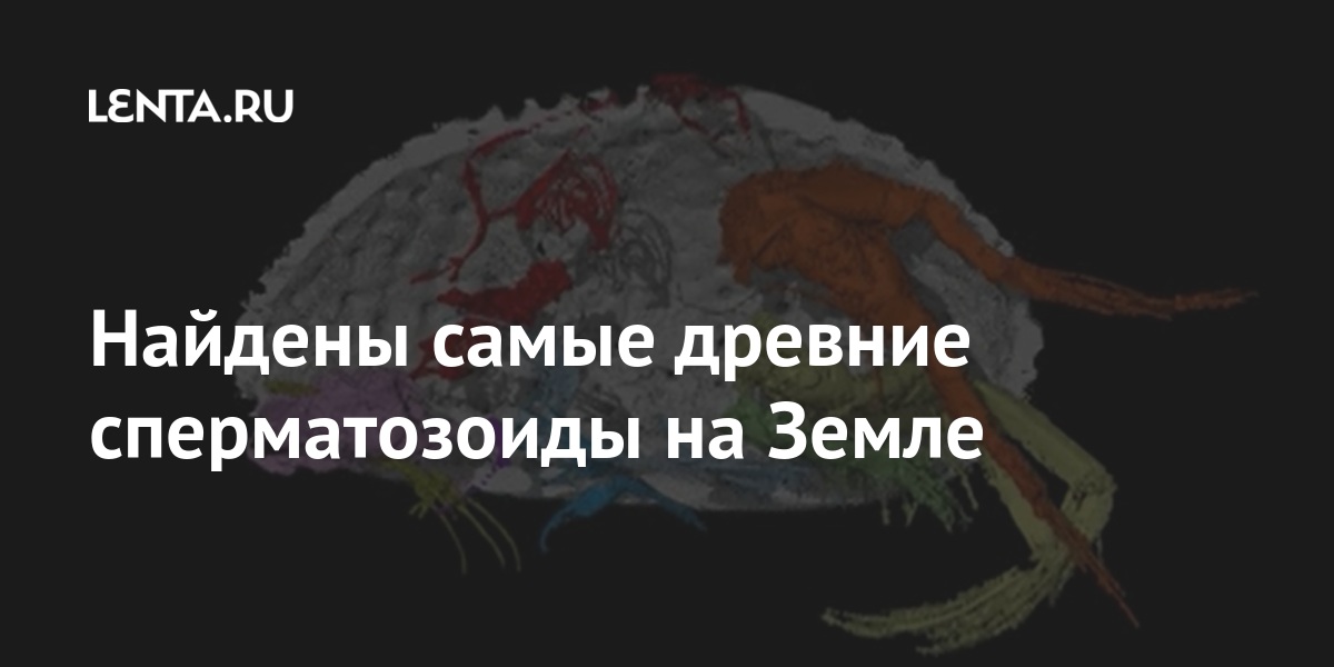 Мужское бесплодие – симптомы, причины, признаки, диагностика и лечение в «СМ-Клиника»