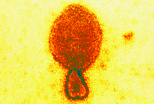 Цветная трансмиссионная электронная микрофотография вириона Хендры